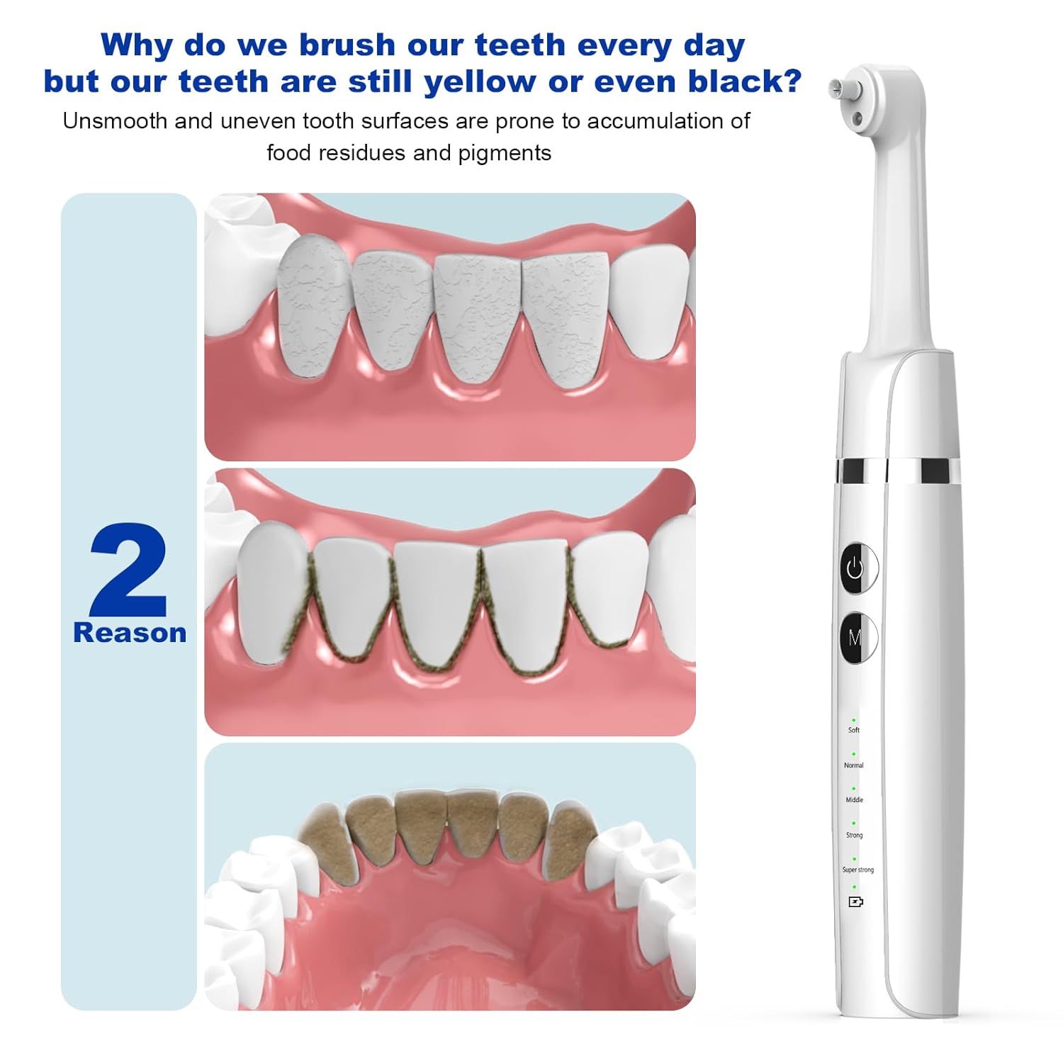ProSmile Dental Polisher